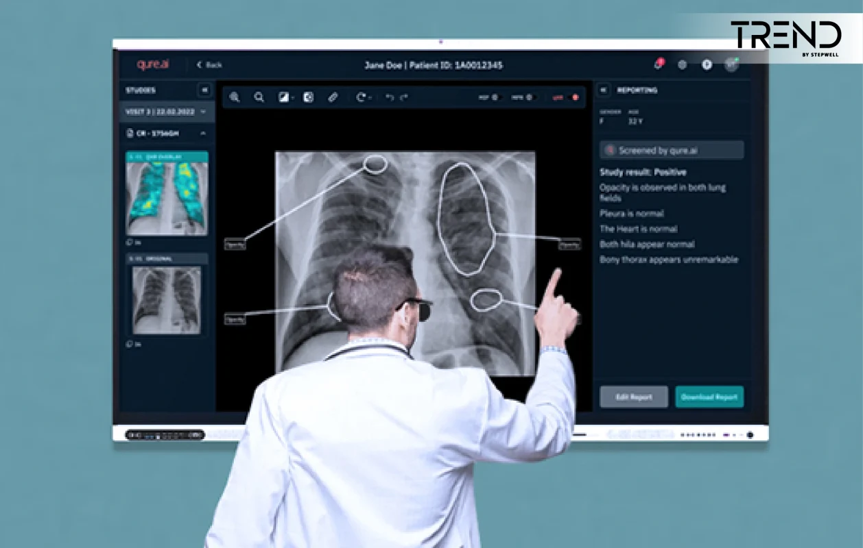 Smart Options for Accuracy And Trendy Features